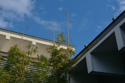 节段型白癜风注意保健